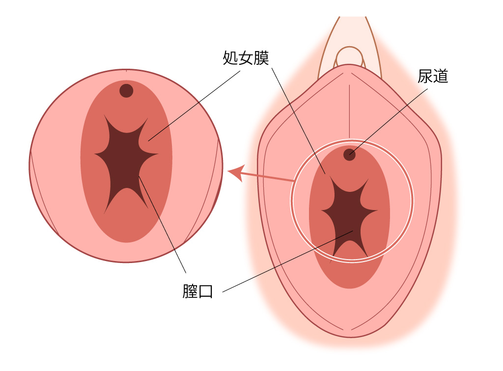 処女膜位置